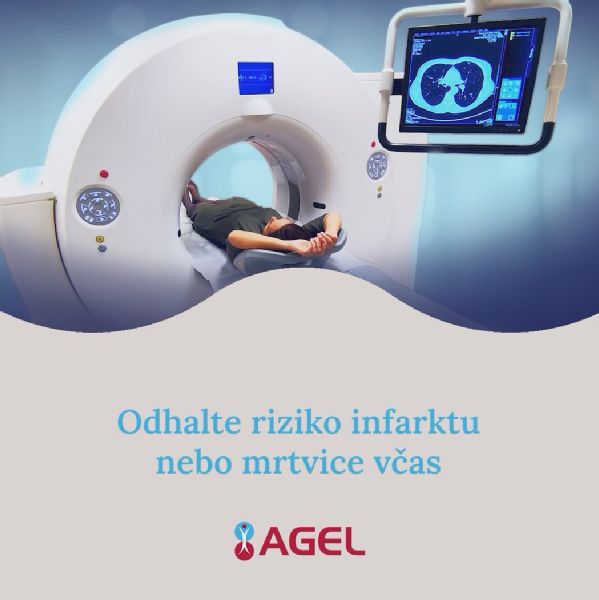 Odhalte riziko infarktu nebo mrtvice včas díky prémiovému vyšetření CT kalciové skóre