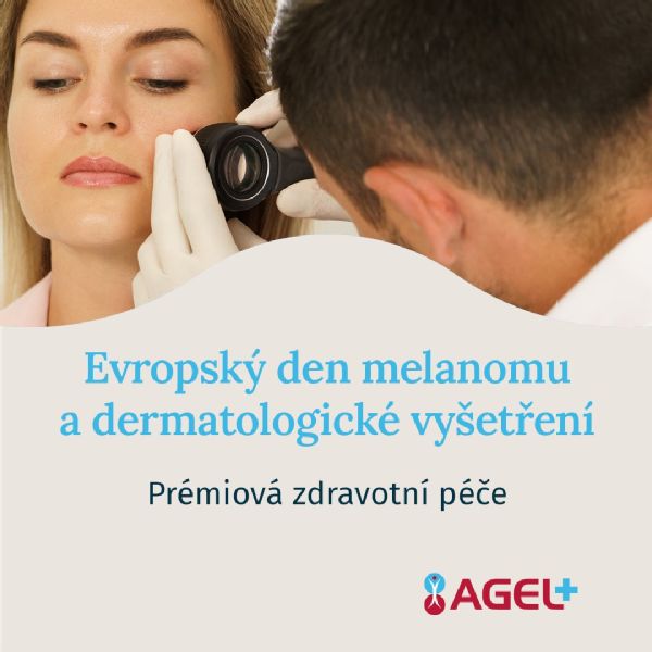 Evropský den melanomu: Myslete na své zdraví a využijte prémiové dermatologické vyšetření v AGEL Plus